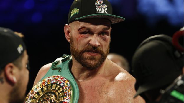 Tyson Fury struggled with a deep cut above his right eye from the third round